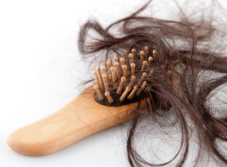 Hair Loss after Bariatric Surgery