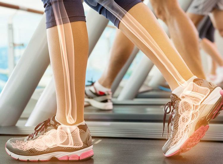 Bone Density after Bariatric Surgery