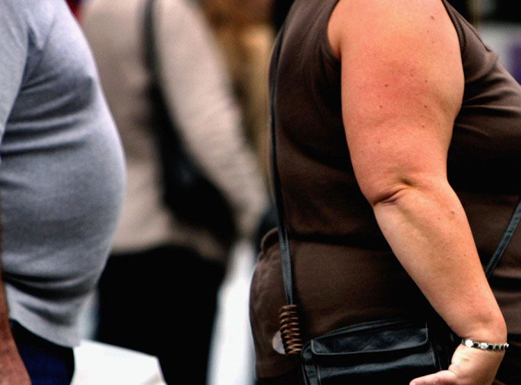Obesity As A Risk Factor | Perth Weight Loss And Surgery