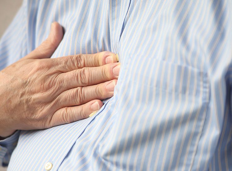 Reflux After Bariatric Surgery